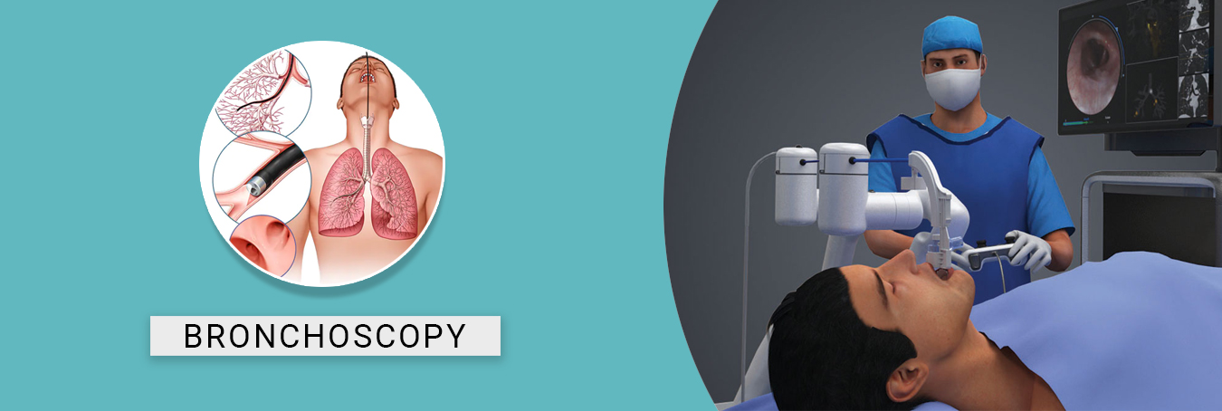 Bronchoscopy